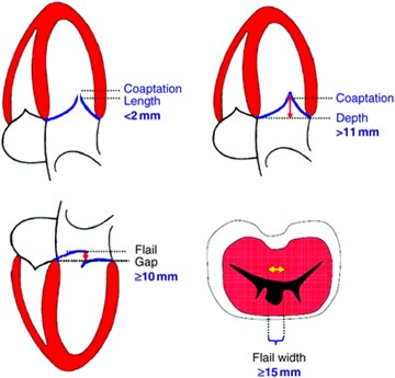 mitral-clip-2
